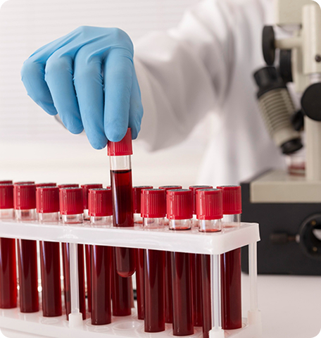 lab-blood-tests