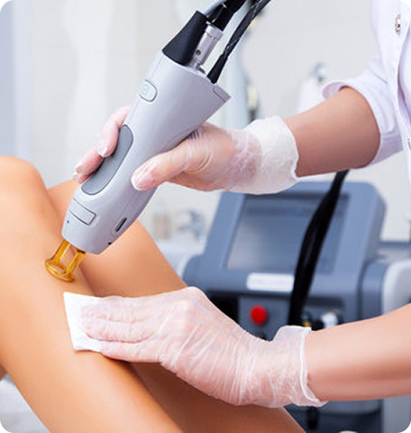 laser-hair-removal